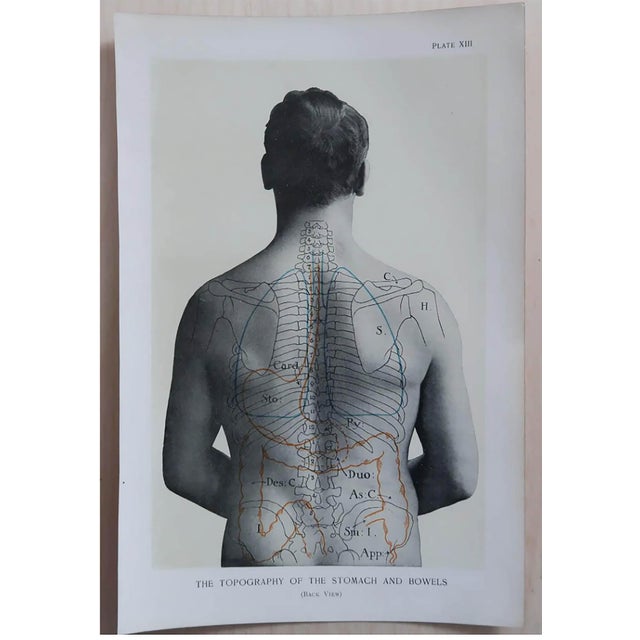 Paper Vintage Medical Prints, 1900, Set of 8, Paper For Sale - Image 7 of 10