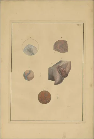 F.D. Reisseisen, Lungs, 1822, Paper
