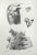 Diseases of the Extremities is a lithograph hand colored by Ottavio Muzzi for the edition of Antoine Chazal, Human...