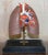 Vintage Anatomical Model of Human Lungs in Display Case For Sale - Image 6 of 13