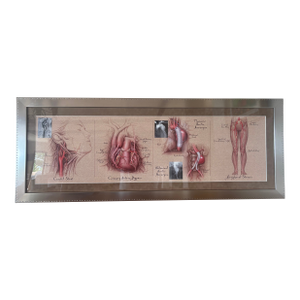 Custom Anatomy Artwork - Showcasing Arteries