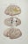 Diseases of the Brain a lithograph hand colored by Ottavio Muzzi for the edition of Antoine Chazal, Human Anatomy,...