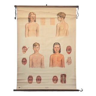 Vintage Training Poster with Childhood Illnesses, 1930-1940 For Sale