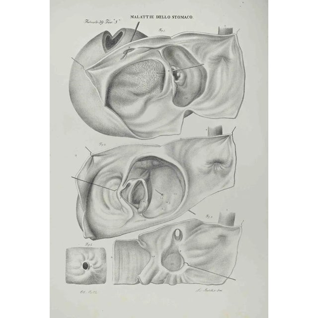 Ottavio Muzzi, Stomach Diseases, Lithograph, 1843 For Sale