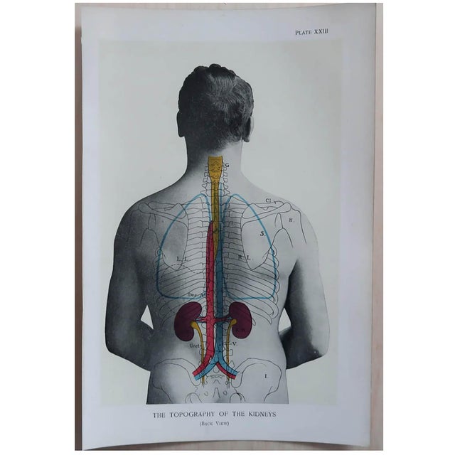 1900 - 1909 Vintage Medical Prints, 1900, Set of 8, Paper For Sale - Image 5 of 10