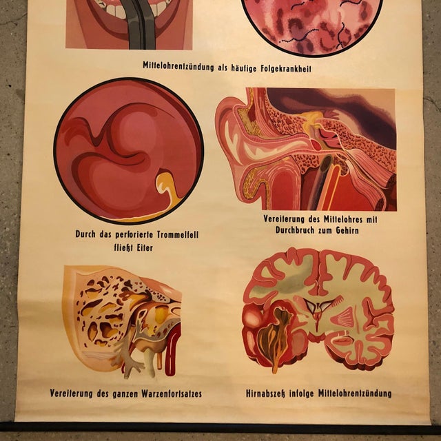 Mid 20th Century Mid 20th Century German Educational Anatomical Sepsis Study Chart For Sale - Image 5 of 12