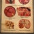 Mid 20th Century Mid 20th Century German Educational Anatomical Sepsis Study Chart For Sale - Image 5 of 12