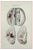 Ottavio Muzzi, Brain Diseases, Lithograph, 1843 For Sale