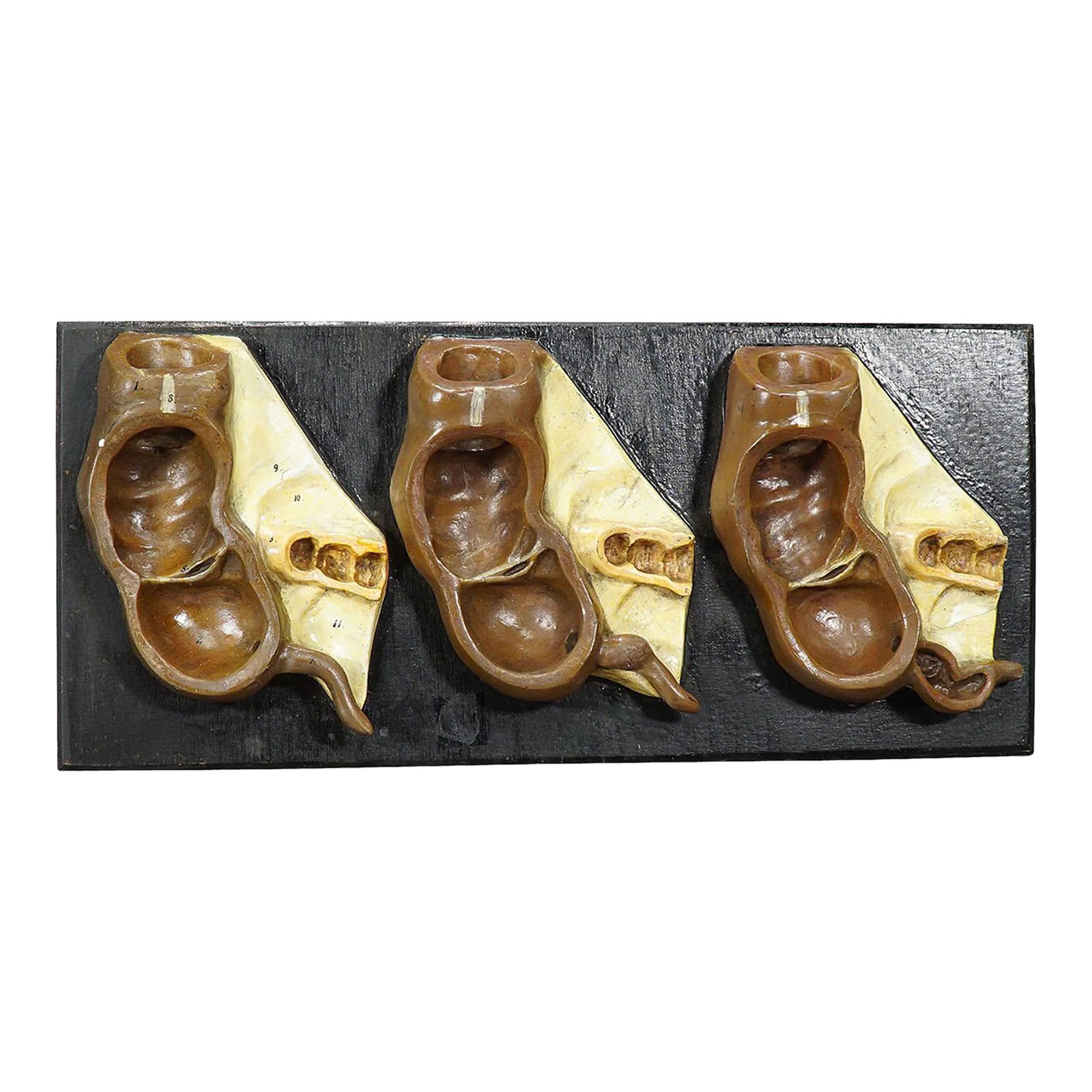 Antique Teaching Model Stages of the Appendix, Ca. 1900 | Chairish