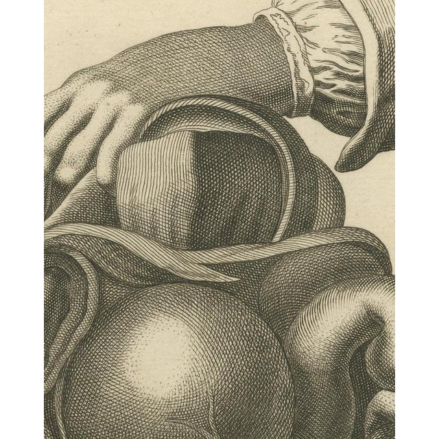 Fambrini, Opened Abdomen and Bladder Dissection, Diderot Chirurgie ...