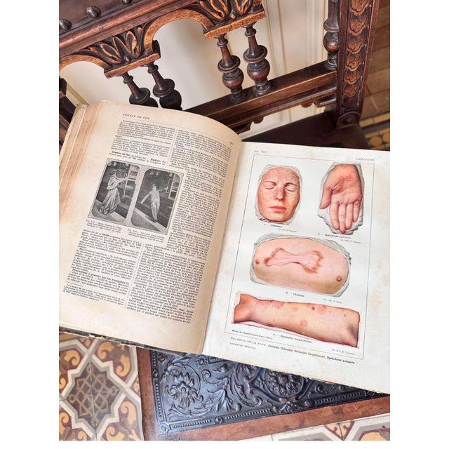 1920s Antique 1920 Larousse Médical Illustré, French Medical Encyclopedia, Book, Antiquarian For Sale - Image 5 of 9