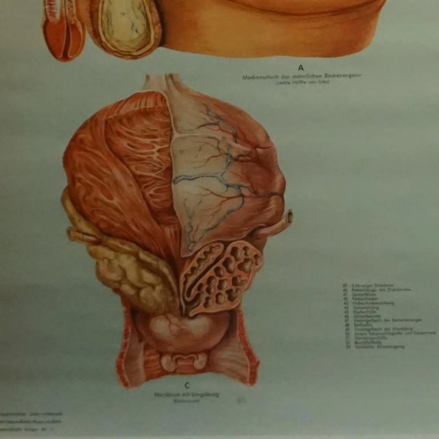 Vintage Male Pelvic Organs Medical Poster Pull Down Wall Chart For Sale - Image 4 of 7