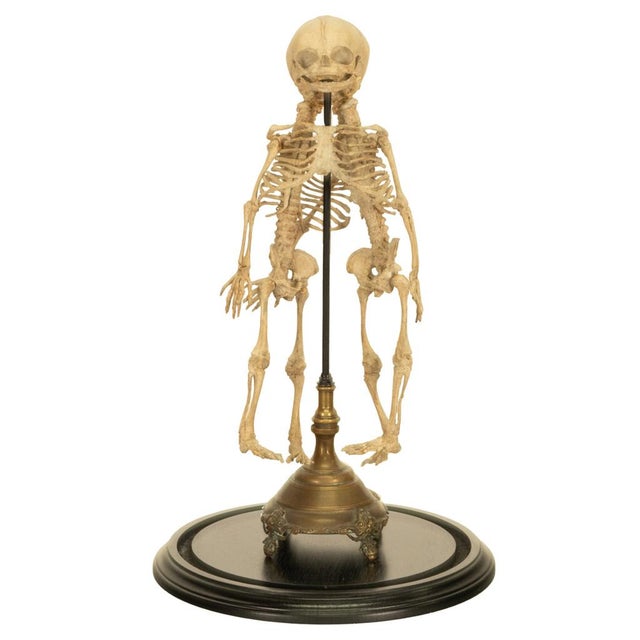 Antique 19thC Anatomical Conjoined Syncephalus Twins Skeleton Medical Model 1860 For Sale In Portland, OR - Image 6 of 17