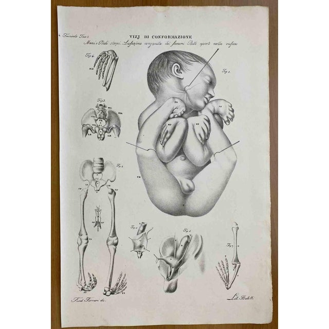 Ottavio Muzzi, Conformation Defects, Lithograph, 1843 For Sale