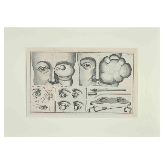 Lorenz Heister, Surgery of the Eye, Etching, 1750 For Sale