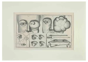 Lorenz Heister, Surgery of the Eye, Etching, 1750