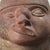 Red Rare Pre-Colonial Moche Portrait Head Vessel With Tumor and Facial Paralysis (Circa a.d. 200-500) For Sale - Image 8 of 10