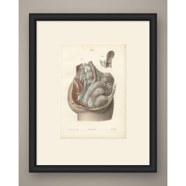 This antique hirschfeld anatomy print of the nerves of the male pelvic viscera is plate 72 from hirschfeld and leveille's...