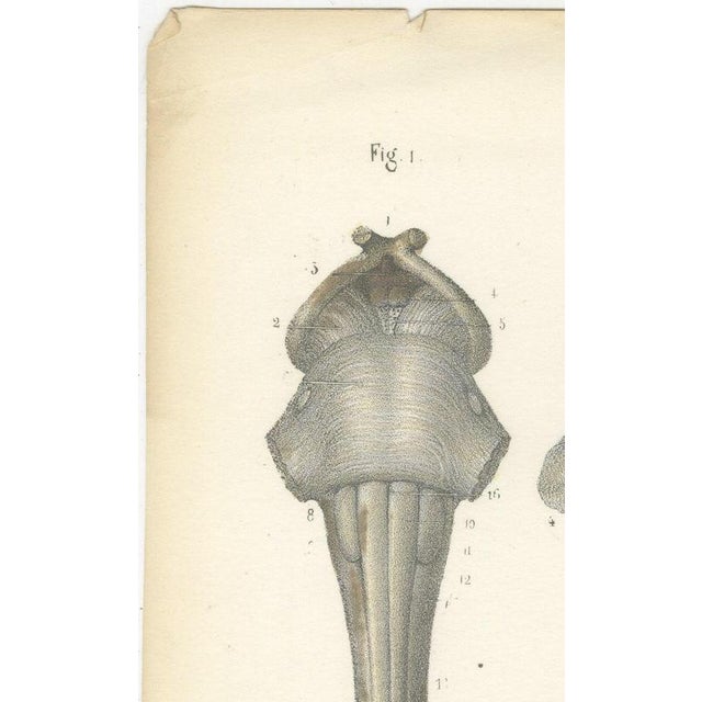 Hirschfeld and Leveille, Spinal Cord and Its Serial Sections, Hirschfeld Double Folding Plate, 1866, Paper For Sale - Image 6 of 12
