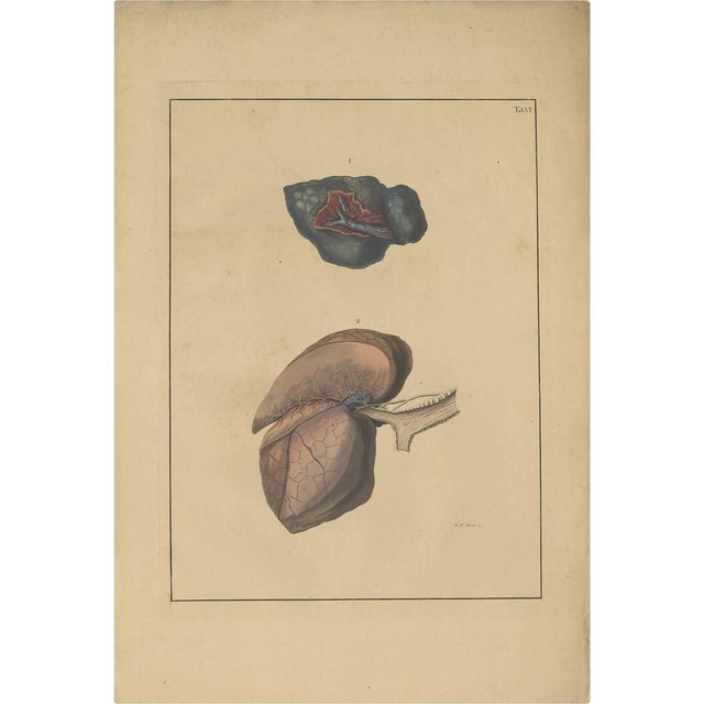 Early 19th Century Antique Medical Print of Lungs Tab. 6 by f.d. Reisseisen, 1822 For Sale - Image 5 of 5