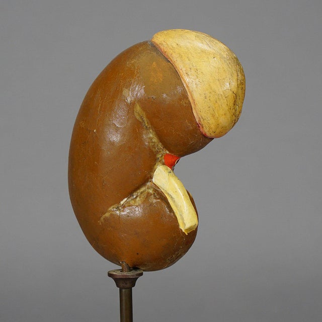 Antique Teaching Model Longitudinal Profile of the Kidney, Ca. 1900 For Sale - Image 4 of 6