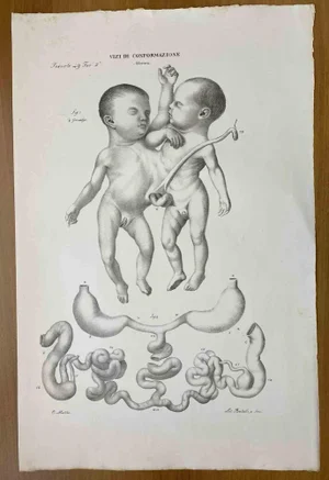 Ottavio Muzzi, Conformation Defects, Lithograph, 1843