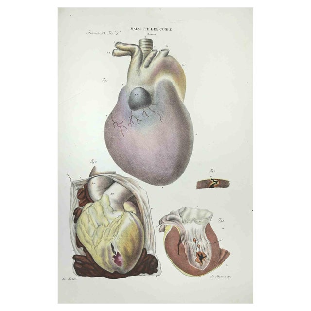 Ottavio Muzzi, Heart Diseases, Lithograph, 1843 For Sale
