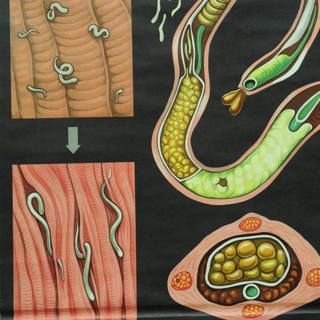 Trichina Rollable Poster Print Wall Chart by Jung Koch Quentell For Sale - Image 4 of 6