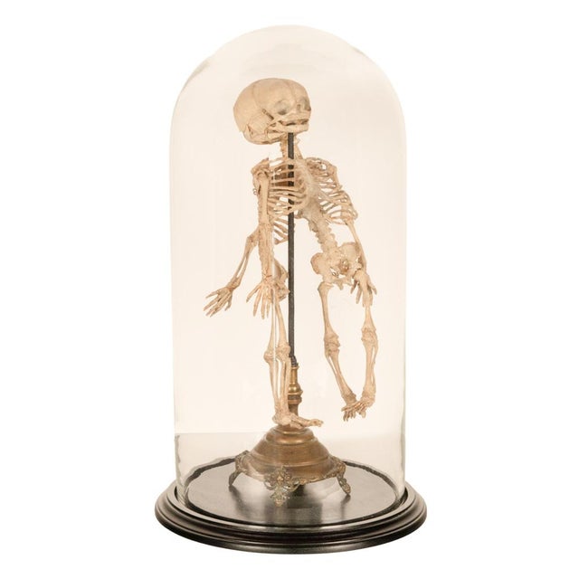 Victorian Antique 19thC Anatomical Conjoined Syncephalus Twins Skeleton Medical Model 1860 For Sale - Image 3 of 17