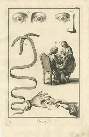D. Diderot, Medical Plate XXIV, 1760, Print