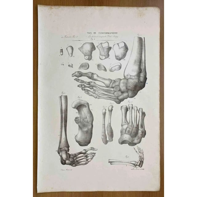 Ottavio Muzzi, Conformation Defects, Lithograph, 1843 For Sale