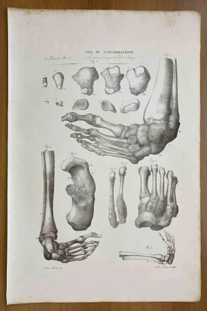 Ottavio Muzzi, Conformation Defects, Lithograph, 1843