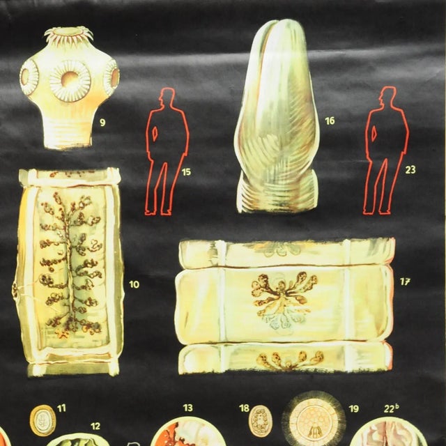 Vintage Tapeworm Parasite Medical Pull Down Wall Chart For Sale - Image 3 of 6