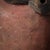 Early 20th Century Pende Mask For Sale - Image 4 of 11