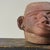 Rare Pre-Colonial Moche Portrait Head Vessel With Tumor and Facial Paralysis (Circa a.d. 200-500) For Sale In Philadelphia - Image 6 of 10