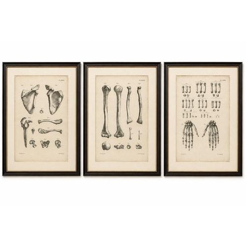 Title: Set of Three Original French Anatomical Lithographs of the Spine and Pelvis by Jules Cloquet, Paris, 1821–1831 : An...