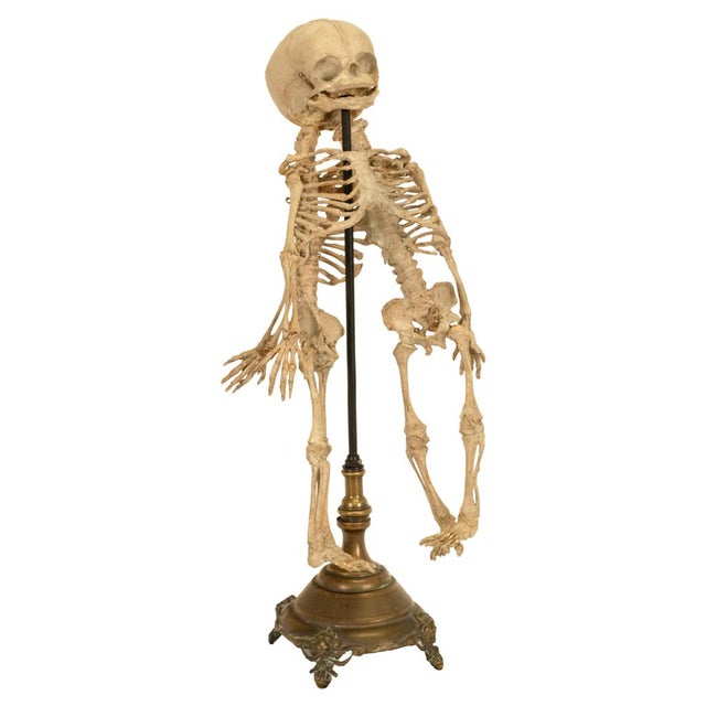 Antique 19thC Anatomical Conjoined Syncephalus Twins Skeleton Medical Model 1860 For Sale - Image 9 of 17