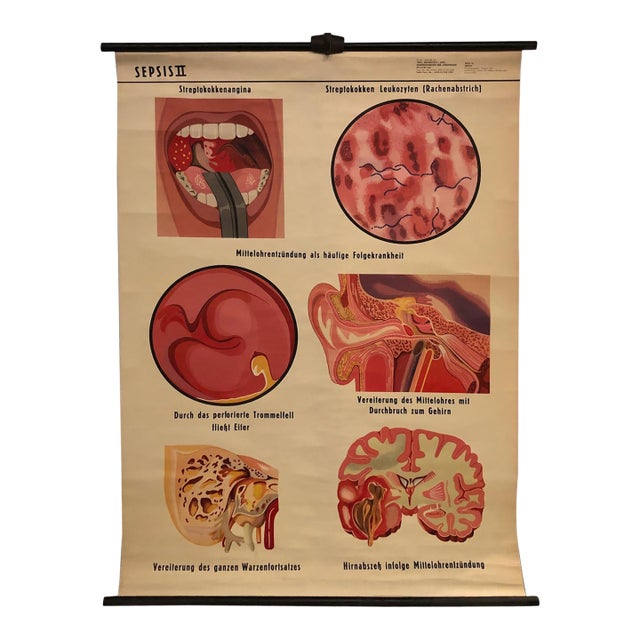 Mid 20th Century German Educational Anatomical Sepsis Study Chart For Sale